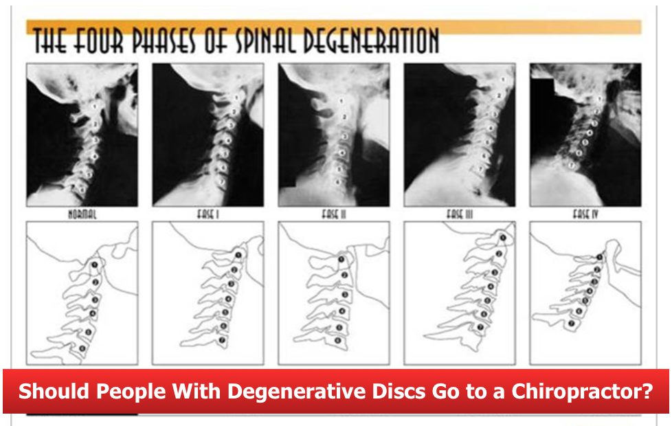 Degenerative Discs_Chiropractor Austin_corrective chiropractic bee caves TX