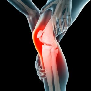 knee pain, pain, chronic pain